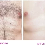 Rio Total Body Waxing Kit - Hair Removal System - Image 2