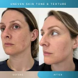 Sensse Firmify LED 3-in-1 Facial Treatment Tool - Image 16
