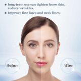 Skin Tightening Face Massager – EMS Heat Therapy for Anti-Wrinkle Care - Image 2
